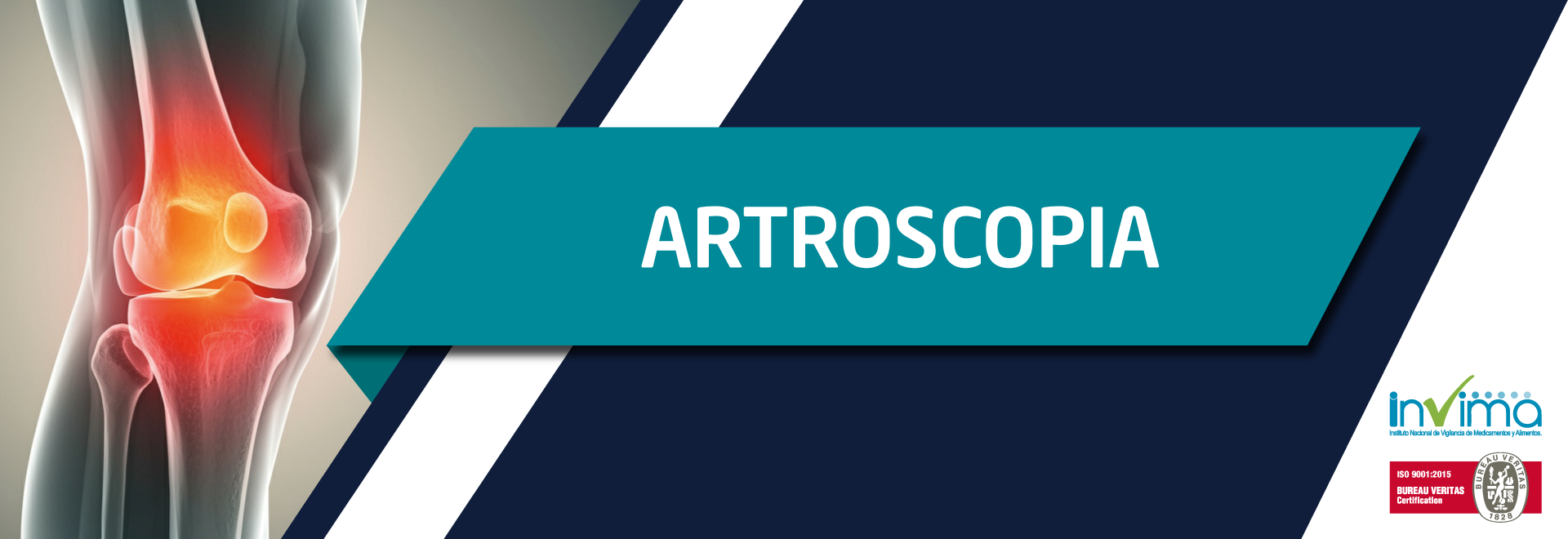 Banner-Línea-Artroscopia