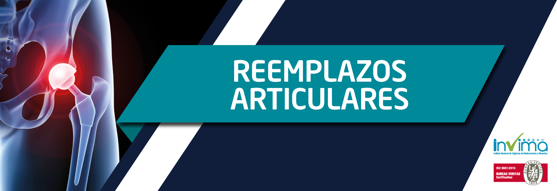 Banner-Línea-Reemplazos-Articulares